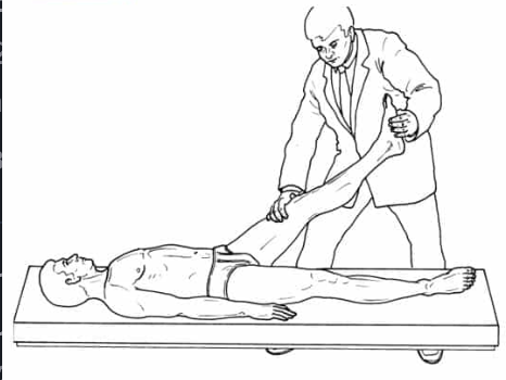 Lasègue征示意图